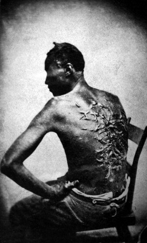 former slave named Gordon shows his whipping scars. Baton Rouge ...