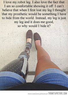 Leg Amputee Inspirational Quotes. QuotesGram