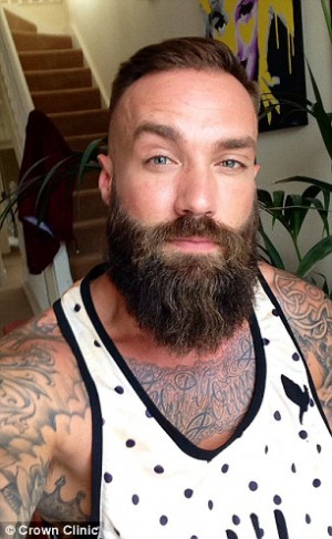 Calum tired of the daily maintenance involved in maintaining the beard ...