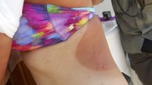 ... attempt record swim again after 'excruciating' pain of jellyfish sting