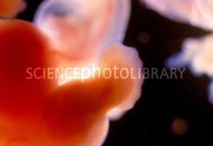 Human Embryo at 7 Weeks