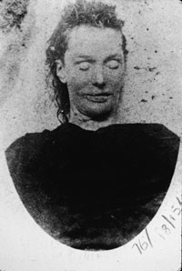 mortuary photograph of Ripper victim Elizabeth Stride.