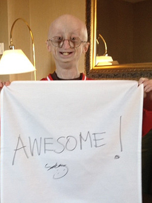 ... Year-Old with Rare Aging Disease, Dies| Death, Tributes, Sheila Nevins