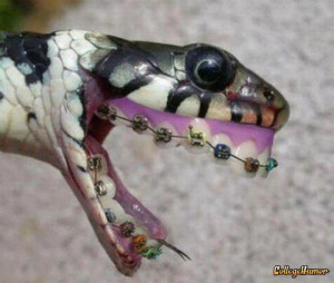 funny snake wearing braces have you ever seen a snake teeth braces ...