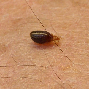 Head Lice Bed Bugs