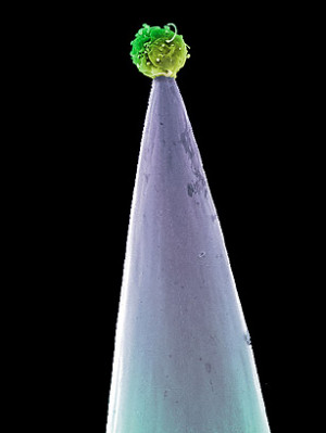 Stem Cell Miracle? New Therapies May Cure Chronic Conditions like ...