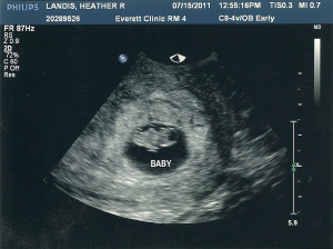baby+3+-+8+week+ultrasound0001.jpg