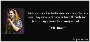 think scars are like battle wounds - beautiful, in a way. They show ...