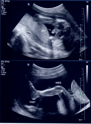 its-a-boy-ultrasound-754x1024.jpg