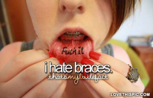 Guys With Braces Quotes I-hate-braces