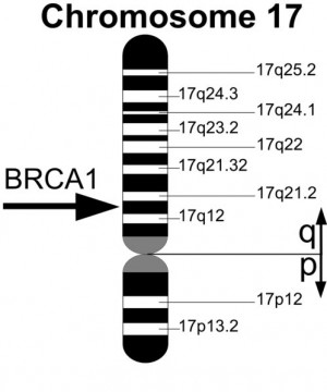 BRCA1 gene locus