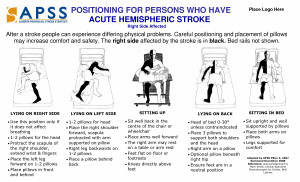 Bed Positioning for Stroke Patients