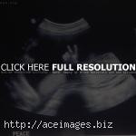 Wallpaper: funny-baby-ultrasound-pics-330 Funny April 6, 2014