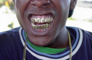 Gangster Jewelry for Teeth