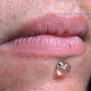 transparent-labret-piercing-for-lip.jpg
