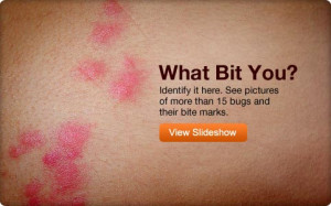 Bed Bug Bite Identification