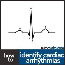 ... Cardiac Arrhythmias (With Videos) And Nursing Responsibilities