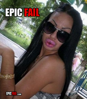 ... epic-beautification-fail-big-lips-hairy-arms-eyebrows_13140111804.jpg