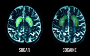 ... the same areas of the brain are “lit up” with sugar and cocaine