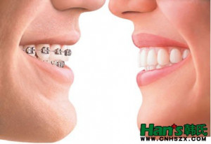 济南整形：牙齿矫正治疗之优点