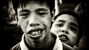 Home > Vietnam War Facts > Agent Orange in the Vietnam War