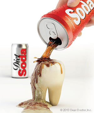 Diet Soda Can Damage Teeth as Severely as Illegal Drugs