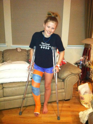 Her Broken Leg Cast