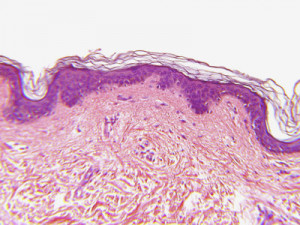 Here are quotes lists related to Cross Section Of Human Skin and check ...