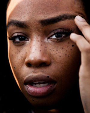 Would You Sport Fake Freckles? We’re Seriously Asking