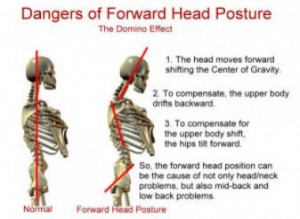 Improve Your Posture One Muscle at a Time