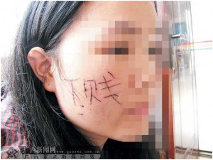 Suspecting wife having affairs, husband tattoos the word “degrading ...
