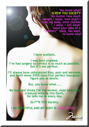 have scoliosis. I've struggled with body image issues my entire life ...