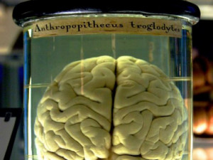 Wikimedia Commons The missing human brains are preserved in jars full ...