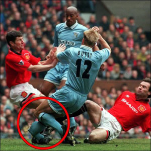 David Busst (April 1996) , compound fracture of the tibia and fibula.