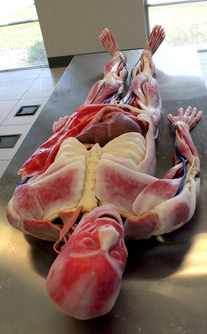 Aspiring doctors of physical therapy to work on cadaver in intensive ...