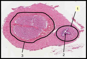Corpus Spongiosum Corpus spongiosum; urethra