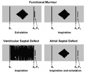Quotes Pictures List: Systolic Murmurs