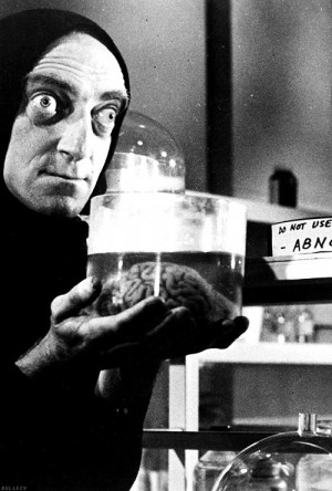 Abby Normal? Marty Feldman in Young Frankenstein. Classic Movie, Abby ...