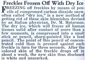 freckles frozen off with dry ice freezing off freckles by means of ...