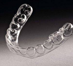 Orthodontic lingual Retainers jpg