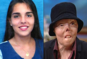 Jacqui Saburido, before and after. Hit by a drunk driver, killed two ...