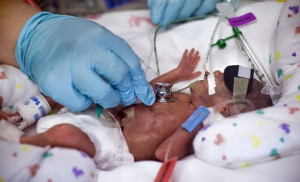 ... consent dilemma: Saving extremely premature babies by signing forms