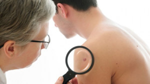 Skin cancer: Genetic mutations 'warn of risk'