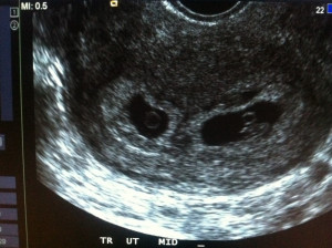 OK so deep down inside I really do like the funny football quotes ...