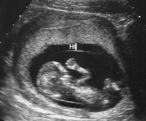 weeks pregnant ultrasound