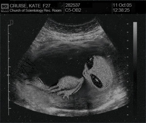 Funny Baby Ultrasound Cartoon