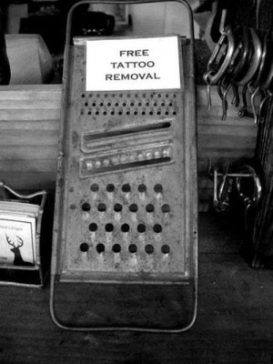 Free removal tatto