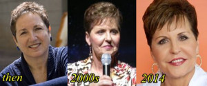 Joyce Meyer Plastic Surgery Before And After