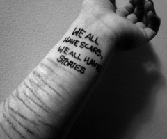 We all have scars, we all have stories.
