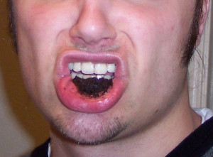 Description Dipping tobacco in mouth.jpg